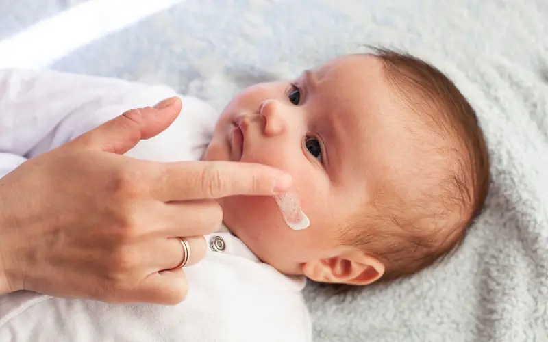 Baby Eczema: Causes & Treatment