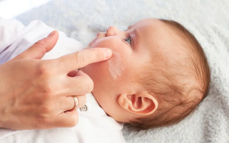 Can You Use Coconut Oil to Treat Baby Eczema