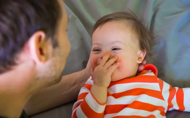 Causes of Flat Head Syndrome in Babies