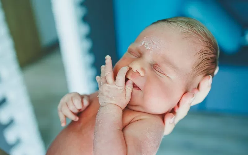Common Skin Conditions in Babies: What to Watch For