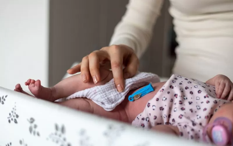 Handling Umbilical Cord Care for Newborns: What to Expect