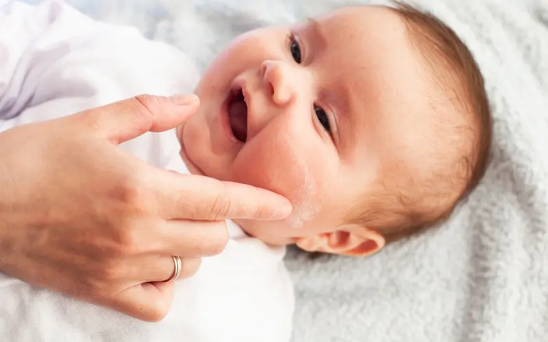 How to Treat Baby Eczema: The Importance of Moisture