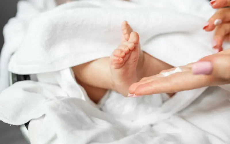 How to Treat Eczema in Babies