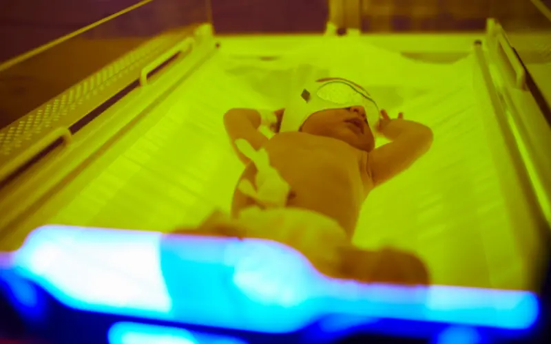 Newborn Jaundice - Discharge and Aftercare