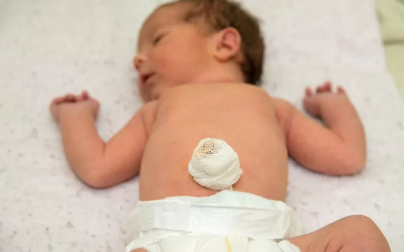Umbilical Cord Care: Do's and Don'ts for Parents